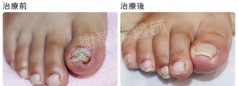 治療前後