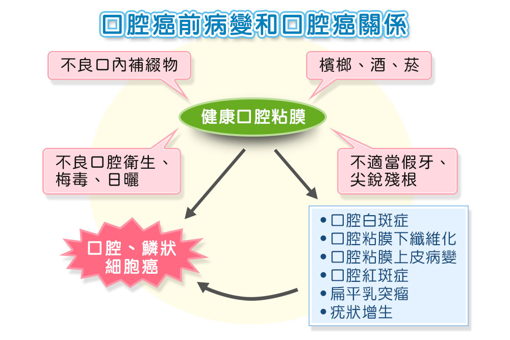 口腔癌前病變與口腔癌關係：檳榔、酒、菸及不良口腔衛生等因素，可能造成口腔白斑、紅斑、黏膜下纖維化等癌前病變，進而形成口腔鱗狀細胞癌